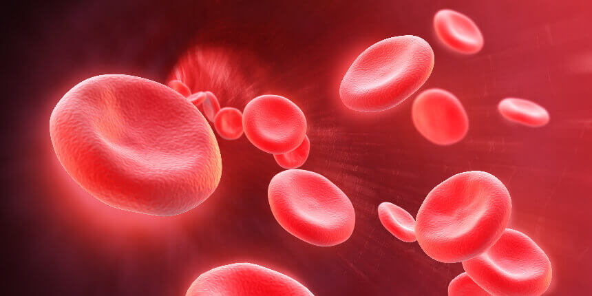 Myelofibrosis